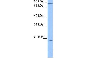 WB Suggested Anti-ARPC3 Antibody Titration: 0. (ARPC3 antibody  (N-Term))