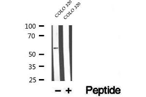 Western blot analysis of extracts of COLO 320 cells, using WSB1 antibody. (WSB1 antibody  (Internal Region))