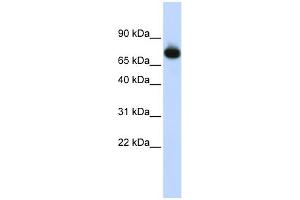 WB Suggested Anti-PATZ1 Antibody Titration:  0. (PATZ1 antibody  (Middle Region))