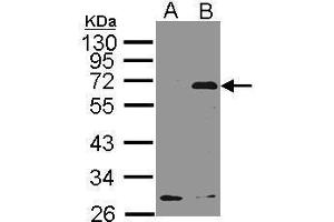 WB Image Western Blot analysis of NET1 expression in transfected 293T cell line by NET1 polyclonal antibody.