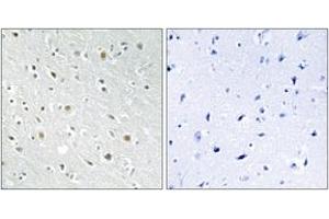 Immunohistochemistry analysis of paraffin-embedded human brain tissue, using SSBP2 Antibody.