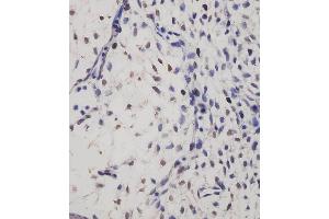 (ABIN6244107 and ABIN6577237) staining SUFU in mouse embryo tissue sections by Immunohistochemistry (IHC-P - paraformaldehyde-fixed, paraffin-embedded sections). (SUFUH antibody)