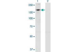Western Blot analysis of ADNP expression in transfected 293T cell line by ADNP monoclonal antibody (M02), clone 2C5.