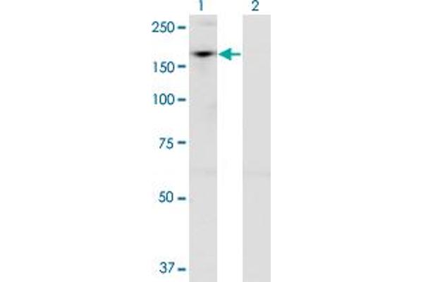 ADNP Antikörper  (AA 1018-1102)