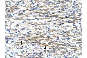 Image no. 1 for anti-Four and A Half LIM Domains 2 (FHL2) (AA 199-248) antibody (ABIN202003) (FHL2 antibody  (AA 199-248))