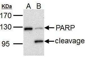 WB Image PARP1 antibody detects PARP1 protein by Western blot analysis. (PARP1 antibody)