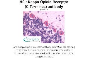 Image no. 1 for anti-Opioid Receptor, kappa 1 (OPRK1) (C-Term) antibody (ABIN1736160) (OPRK1 antibody  (C-Term))