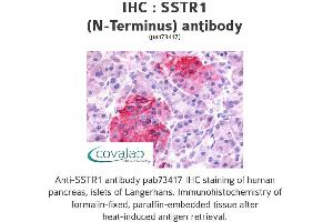 Image no. 1 for anti-Somatostatin Receptor 1 (SSTR1) (Extracellular Domain), (N-Term) antibody (ABIN1739669)