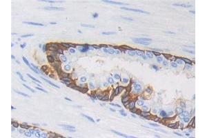 CYFRA21.1 antibody  (AA 244-400)