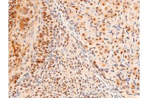 Immunohistochemistry (IHC) image for anti-Jun Proto-Oncogene (JUN) (pThr91) antibody (ABIN6256604)