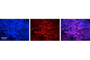 Rabbit Anti-MAX Antibody   Formalin Fixed Paraffin Embedded Tissue: Human Lymph Node Tissue Observed Staining: Nucleus Primary Antibody Concentration: 1:100 Other Working Concentrations: N/A Secondary Antibody: Donkey anti-Rabbit-Cy3 Secondary Antibody Concentration: 1:200 Magnification: 20X Exposure Time: 0. (MAX antibody  (Middle Region))