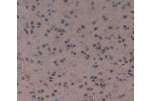 Immunohistochemistry (IHC) image for anti-Myocyte Enhancer Factor 2A (MEF2A) (AA 1-160) antibody (ABIN5013966)