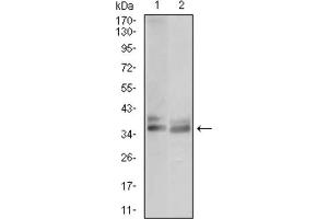 Western Blotting (WB) image for anti-Acid Phosphatase 5, Tartrate Resistant (ACP5) (AA 221-325) antibody (ABIN1846241) (ACP5 antibody  (AA 221-325))