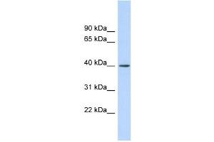 RAD51AP1 antibody used at 1 ug/ml to detect target protein. (RAD51AP1 antibody  (Middle Region))