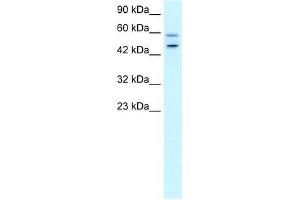Human HepG2; WB Suggested Anti-DKFZP761C169 Antibody Titration: 0. (GC-Rich Promoter Binding Protein 1 (GPBP1) (N-Term) antibody)