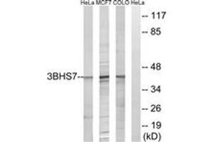 Western blot analysis of extracts from HeLa/MCF-7/COLO cells, using HSD3B7 Antibody. (HSD3B7 antibody  (AA 121-170))