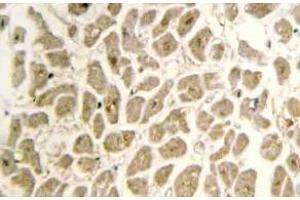 Immunohistochemistry (IHC) analyzes of Siah-2 antibody in paraffin-embedded human heart tissue. (SIAH2 antibody)