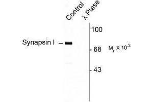 Image no. 1 for anti-Synapsin I (SYN1) (pSer9) antibody (ABIN372718)