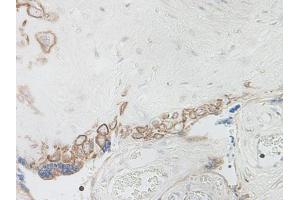 Image no. 5 for anti-Interleukin 15 (IL15) antibody (ABIN464931) (IL-15 antibody)