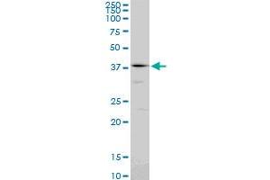 PSMC6 monoclonal antibody (M02), clone 2C4.