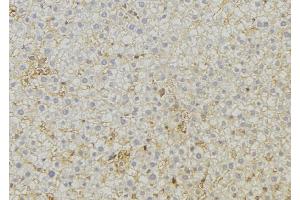 ABIN6279555 at 1/100 staining Mouse liver tissue by IHC-P. (ABCC6 antibody  (Internal Region))