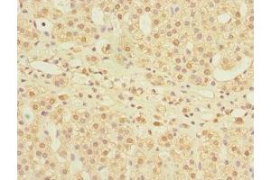 Immunohistochemistry of paraffin-embedded human adrenal gland tissue using ABIN7158982 at dilution of 1:100 (MPI antibody  (AA 1-423))