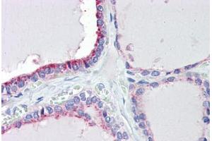 Human Thyroid (formalin-fixed, paraffin-embedded) stained with TRIM68 antibody ABIN462217 followed by biotinylated goat anti-rabbit IgG secondary antibody ABIN481713, alkaline phosphatase-streptavidin and chromogen. (TRIM68 antibody  (AA 395-444))