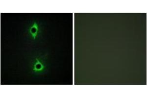Immunofluorescence (IF) image for anti-phosphoinositide Kinase, FYVE Finger Containing (PIKFYVE) (AA 71-120) antibody (ABIN2889821) (PIKFYVE antibody  (AA 71-120))