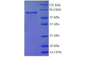 SDS-PAGE (SDS) image for N-Acetylglucosamine Kinase (NAGK) (AA 2-344) protein (His-SUMO Tag) (ABIN5711907) (NAGK Protein (AA 2-344) (His-SUMO Tag))