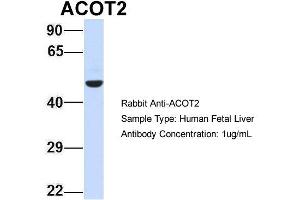 Host: Rabbit Target Name: ACOT2 Sample Type: Human Fetal Liver Antibody Dilution: 1.