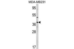 Image no. 1 for anti-BCL2-Associated Athanogene (BAG1) (C-Term) antibody (ABIN452778) (BAG1 antibody  (C-Term))