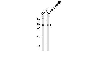 Western blot analysis of lysates from mouse brain, mouse skeletal muscle tissue lysate (from left to right), using OLIG3 Antibody (N-term) (ABIN6242511 and ABIN6577867). (OLIG3 antibody  (N-Term))
