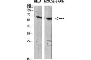 Western Blotting (WB) image for anti-GABA Transporter 1 (GAT1) antibody (ABIN5956621) (SLC6A1 antibody)