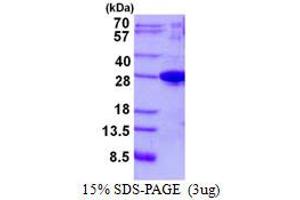 Image no. 1 for Josephin Domain Containing 1 (JOSD1) protein (His tag) (ABIN1098419) (JOSD1 Protein (His tag))