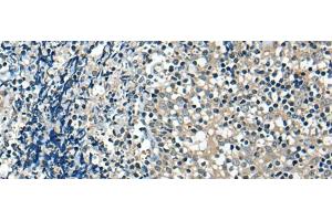 Immunohistochemistry of paraffin-embedded Human tonsil tissue using USP12 Polyclonal Antibody at dilution of 1:35(x200) (USP12 antibody)