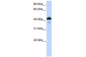 SFTPB antibody used at 1 ug/ml to detect target protein. (SFTPB antibody  (Middle Region))