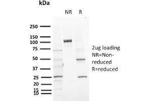SDS-PAGE Analysis Purified CD72 Mouse Monoclonal Antibody (BU40).