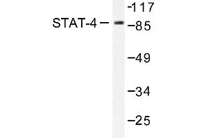 Image no. 2 for anti-Signal Transducer and Activator of Transcription 4 (STAT4) antibody (ABIN271914) (STAT4 antibody)