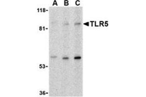 Western blot analysis of TLR5 in THP-1 cell lysate with this product at (A) 0.