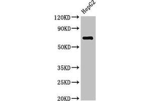 Western Blot Positive WB detected in: HepG2 whole cell lysate All lanes: ST6GALNAC1 antibody at 2. (ST6GALNAC1 antibody  (AA 36-249))