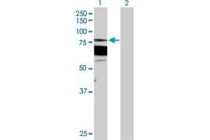 Western Blot analysis of PRKCB expression in transfected 293T cell line by PRKCB MaxPab polyclonal antibody. (PKC beta antibody  (AA 1-671))