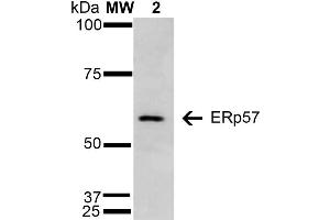 Western Blot analysis of Human Cervical Cancer cell line (HeLa) showing detection of 57 kDa Erp57 protein using Mouse Anti-Erp57 Monoclonal Antibody, Clone 4F9 . (PDIA3 antibody  (AA 25-505) (Atto 390))