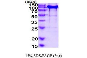 SDS-PAGE (SDS) image for Neuropilin 1 (NRP1) (AA 22-855) protein (His tag) (ABIN7529325) (Neuropilin 1 Protein (NRP1) (AA 22-855) (His tag))