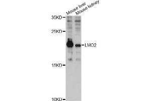 Western blot analysis of extracts of various cell lines, using LMO2 antibody (ABIN6293053) at 1:3000 dilution.