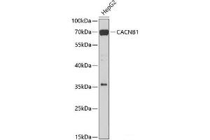 Western blot analysis of extracts of HepG2 cells using CACNB1 Polyclonal Antibody at dilution of 1:1000. (CACNB1 antibody)