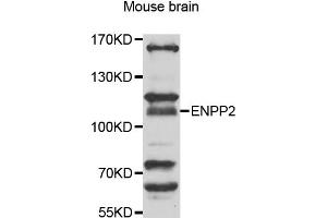 Western blot analysis of extracts of mouse brain, using ENPP2 antibody (ABIN5975354) at 1/1000 dilution. (ENPP2 antibody)