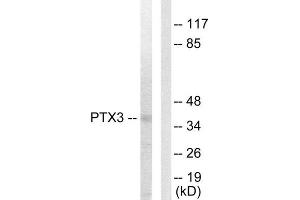 Western Blotting (WB) image for anti-Pentraxin 3 (PTX3) (N-Term) antibody (ABIN1849270)