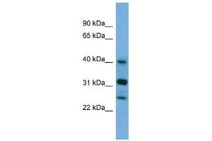 PPHLN1 antibody used at 0.