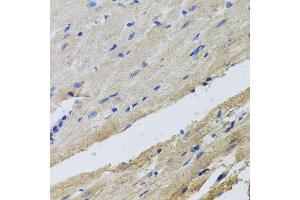 Immunohistochemistry of paraffin-embedded rat heart using FECH antibody at dilution of 1:100 (x40 lens). (FECH antibody)