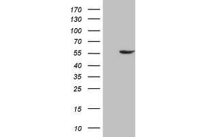 Western Blotting (WB) image for anti-4-Aminobutyrate Aminotransferase (ABAT) (AA 29-323) antibody (ABIN2715594)